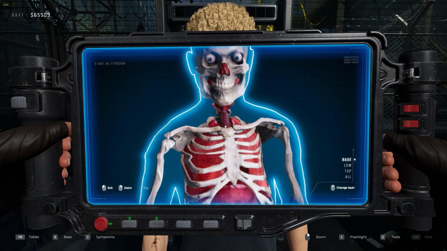 An X-Ray scanning someone's insides